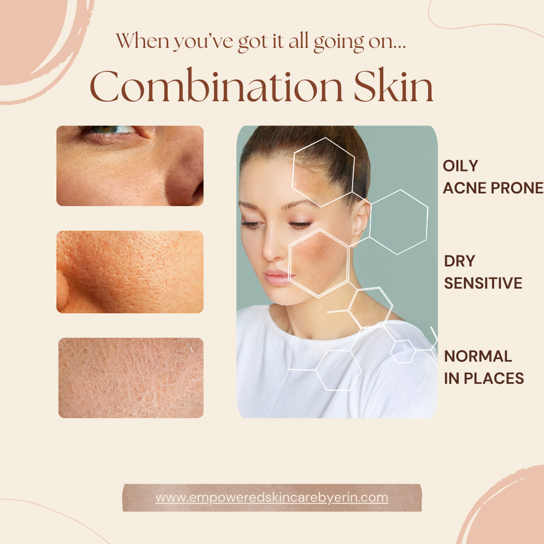 combination skin and how to treat it