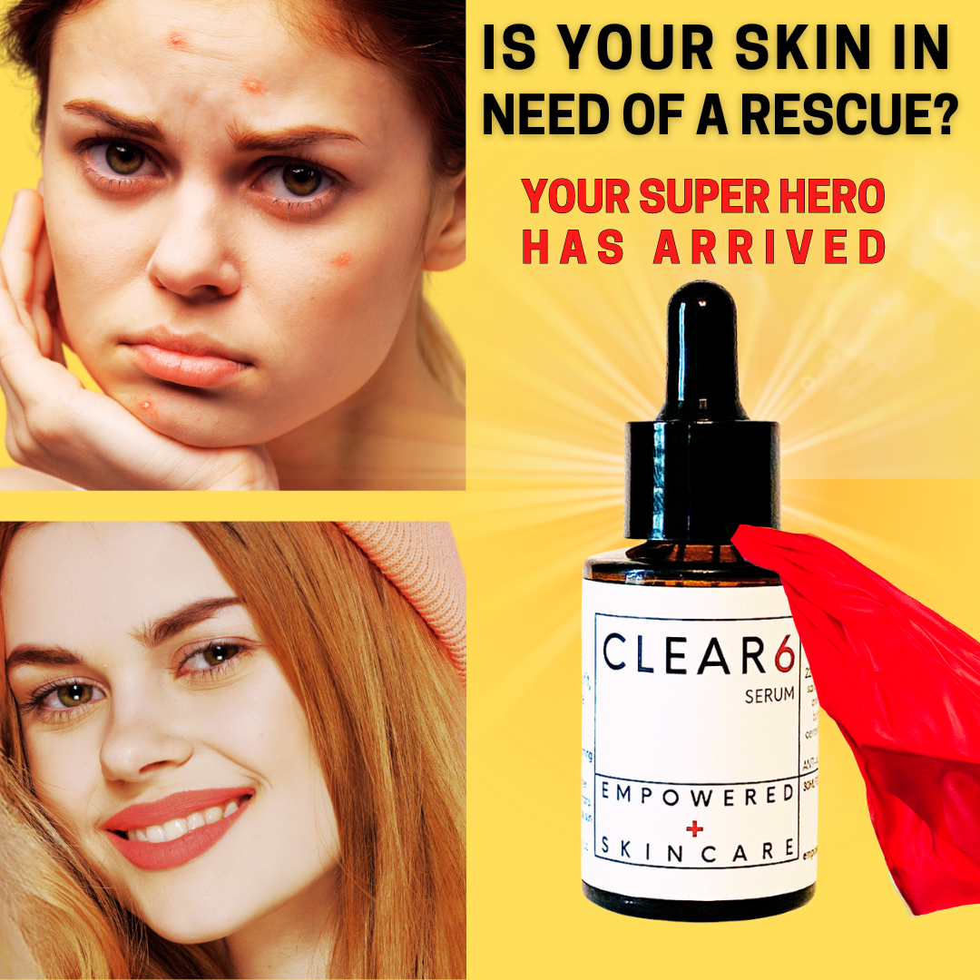 Clear 6 Serum, formulated to rescue skin by treating acne, reducing redness, and fighting signs of aging.